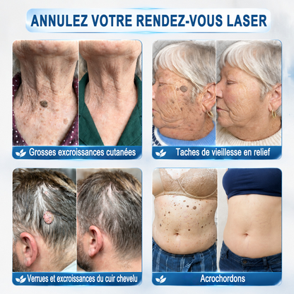 🔥 Boutique Officielle HEATWOLF® 🔥 | Soin Ciblé Taches & Imperfections en 7 Jours | Sans douleur • Sans cicatrice • Embout roll-on