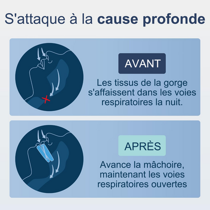 🔥 DERNIER JOUR : -80 % – OFFRE À DURÉE LIMITÉE ! | HEATWOLF™ – Orthèse Anti-Ronflement Ajustable & Confortable | Pour Homme & Femme
