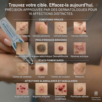 🔥 Boutique Officielle HEATWOLF® 🔥 | Soin Ciblé Taches & Imperfections en 7 Jours | Sans douleur • Sans cicatrice • Embout roll-on