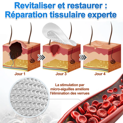 🏥Patch 2-en-1 Curalona® : Microneedle & Hydrocolloïde🍀 | Élimine les grains de beauté en relief, les verrues planes et les acrochordons | Aide à atténuer les rides, les cicatrices et les imperfections | Patch invisible adapté au visage et au corps