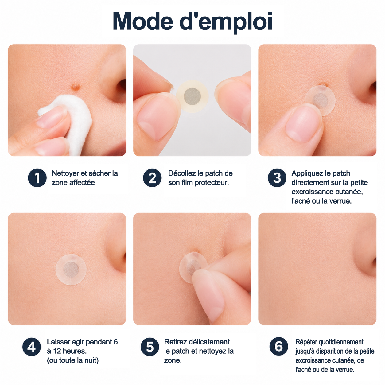 🏥Patch 2-en-1 Curalona® : Microneedle & Hydrocolloïde🍀 | Élimine les grains de beauté en relief, les verrues planes et les acrochordons | Aide à atténuer les rides, les cicatrices et les imperfections | Patch invisible adapté au visage et au corps