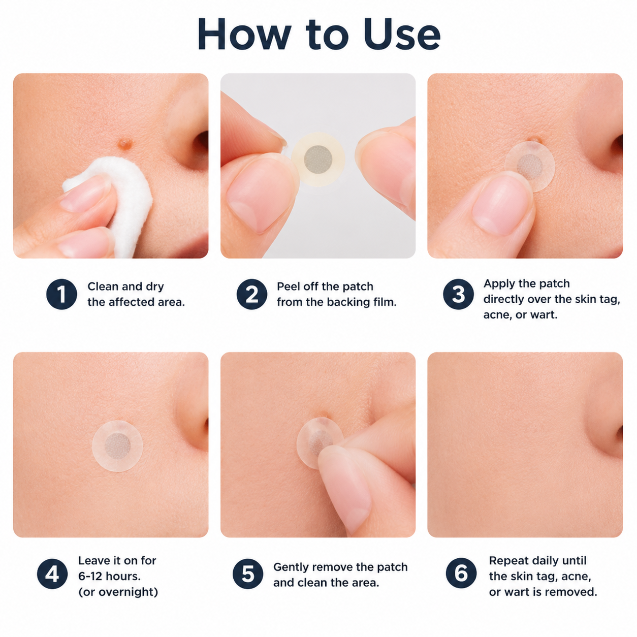 🏥Patch 2-en-1 Curalona® : Microneedle & Hydrocolloïde🍀 | Élimine les grains de beauté en relief, les verrues planes et les acrochordons | Aide à atténuer les rides, les cicatrices et les imperfections | Patch invisible adapté au visage et au corps