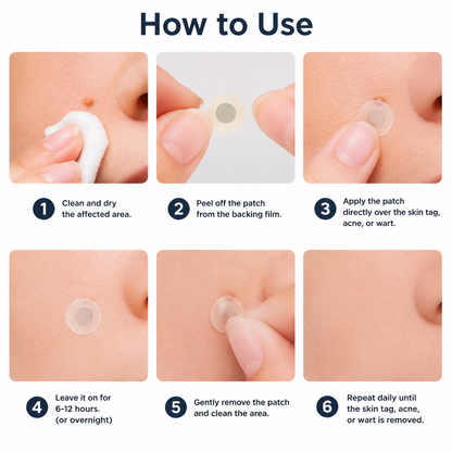 🏥Patch 2-en-1 Curalona® : Microneedle & Hydrocolloïde🍀 | Élimine les grains de beauté en relief, les verrues planes et les acrochordons | Aide à atténuer les rides, les cicatrices et les imperfections | Patch invisible adapté au visage et au corps
