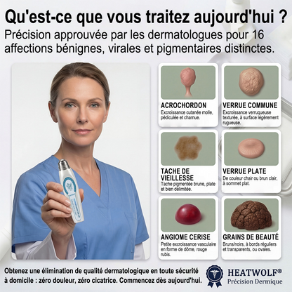 🔥 Boutique Officielle HEATWOLF® 🔥 | Soin Ciblé Taches & Imperfections en 7 Jours | Sans douleur • Sans cicatrice • Embout roll-on